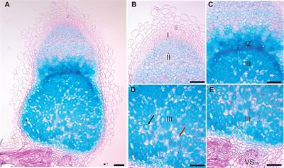 Expression and mutagenesis studies in the Medicago truncatula iron transporter MtVTL8 confirm its role in symbiotic nitrogen fixation and reveal amino acids essential for transport